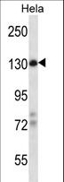 ZBTB11 Antibody - ZBTB11 Antibody western blot of HeLa cell line lysates (35 ug/lane). The ZBTB11 antibody detected the ZBTB11 protein (arrow).