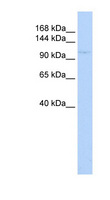 ZBTB11 Antibody - ZBTB11 antibody Western blot of Jurkat lysate. This image was taken for the unconjugated form of this product. Other forms have not been tested.