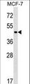 ZBTB12 / G10 Antibody - ZBTB12 Antibody western blot of MCF-7 cell line lysates (35 ug/lane). The ZBTB12 antibody detected the ZBTB12 protein (arrow).