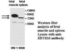 ZBTB16 / PLZF Antibody