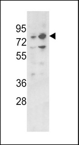 ZBTB16 / PLZF Antibody - Western blot of PLZF Antibody in 293, K562 cell line lysates (35 ug/lane). PLZF (arrow) was detected using the purified antibody.