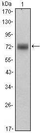 ZBTB16 / PLZF Antibody - PLZF Antibody in Western Blot (WB)