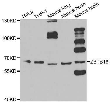 ZBTB16 / PLZF Antibody - Western blot analysis of extracts of various cell lines, using ZBTB16 antibody.