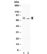 ZBTB16 / PLZF Antibody