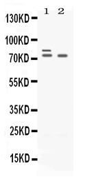 ZBTB16 / PLZF Antibody - Western blot - Anti-Plzf Picoband Antibody