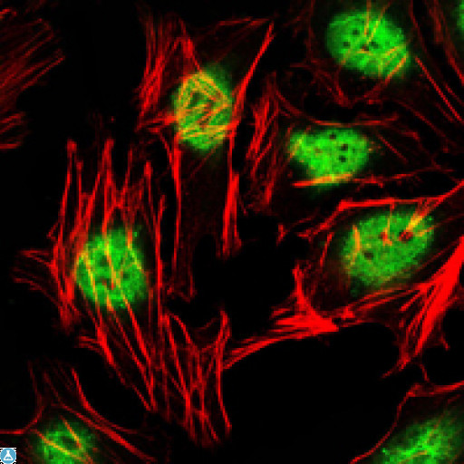 ZBTB16 / PLZF Antibody - Western Blot (WB) analysis using PLZF Monoclonal Antibody against HeLa (1) cell lysate.