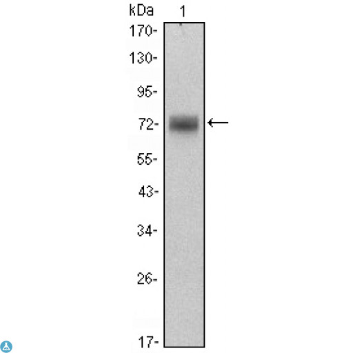 ZBTB16 / PLZF Antibody - Immunofluorescence (IF) analysis of HeLa cells using PLZF Monoclonal Antibody (green). Red: Actin filaments have been labeled with Alexa Fluor-555 phalloidin.