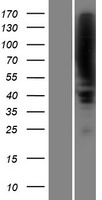 ZBTB16 / PLZF Protein - Western validation with an anti-DDK antibody * L: Control HEK293 lysate R: Over-expression lysate