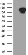 ZBTB17 / MIZ-1 Antibody - HEK293T cells were transfected with the pCMV6-ENTRY control. (Left lane) or pCMV6-ENTRY ZBTB17. (Right lane) cDNA for 48 hrs and lysed. Equivalent amounts of cell lysates. (5 ug per lane) were separated by SDS-PAGE and immunoblotted with anti-ZBTB17. (1:2000)