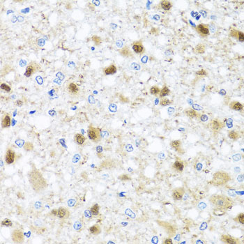 ZBTB17 / MIZ-1 Antibody - Immunohistochemistry of paraffin-embedded rat brain tissue.