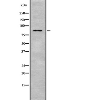 ZBTB17 / MIZ-1 Antibody - Western blot analysis of ZBTB17 using HeLa whole cells lysates