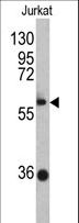 ZBTB2 Antibody - Western blot of ZBTB2 antibody in Jurkat cell line lysates (35 ug/lane). ZBTB2 (arrow) was detected using the purified antibody.