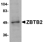 ZBTB2 Antibody - Western blot of ZBTB2 in PC-3 cell lysate with ZBTB2 antibody at 1 ug/ml