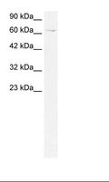 ZBTB20 Antibody - Jurkat Cell Lysate.  This image was taken for the unconjugated form of this product. Other forms have not been tested.