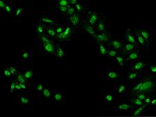 ZBTB20 Antibody - Immunofluorescence staining of ZBTB20 in U251MG cells. Cells were fixed with 4% PFA, permeabilzed with 0.3% Triton X-100 in PBS, blocked with 10% serum, and incubated with rabbit anti-Human ZBTB20 polyclonal antibody (dilution ratio 1:200) at 4°C overnight. Then cells were stained with the Alexa Fluor 488-conjugated Goat Anti-rabbit IgG secondary antibody (green). Positive staining was localized to Nucleus.