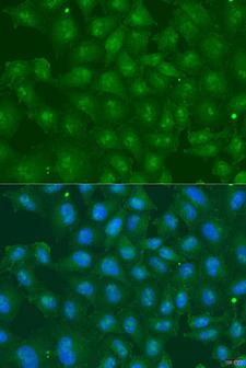 ZBTB20 Antibody - Immunofluorescence analysis of U2OS cells using ZBTB20 Polyclonal Antibody at dilution of 1:100.Blue: DAPI for nuclear staining.