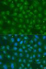 ZBTB20 Antibody - Immunofluorescence analysis of U2OS cells using ZBTB20 Polyclonal Antibody at dilution of 1:100.Blue: DAPI for nuclear staining.