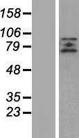 ZBTB20 Protein - Western validation with an anti-DDK antibody * L: Control HEK293 lysate R: Over-expression lysate