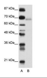 ZBTB22 Antibody - A: Marker, B: Transfected 293T Cell Lysate.  This image was taken for the unconjugated form of this product. Other forms have not been tested.