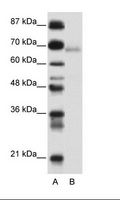 ZBTB22 Antibody - A: Marker, B: Transfected 293T Cell Lysate.  This image was taken for the unconjugated form of this product. Other forms have not been tested.