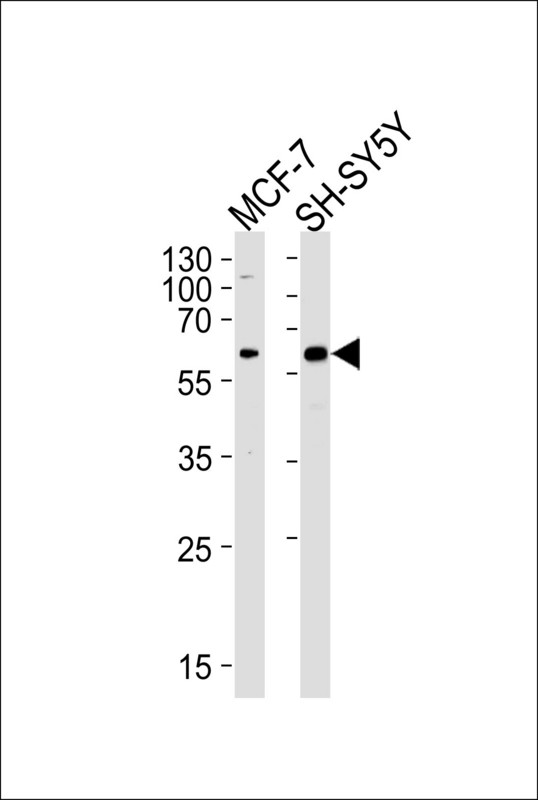 ZBTB22 Antibody - Western blot of lysates from MCF-7, SH-SY5Y cell line (from left to right), using ZBTB22 Antibody. Antibody was diluted at 1:1000 at each lane. A goat anti-rabbit IgG H&L (HRP) at 1:5000 dilution was used as the secondary antibody. Lysates at 35ug per lane.