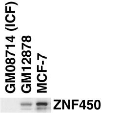 ZBTB24 / BIF1 Antibody - ZBT24 Antibody western blot of ICF, GM12878 and MCF-7 cell line lysates.The ZBT24 antibody detected endogenous ZBT24 protein in MCF-7 and GM12878 cell lines but not in GM08714 cell line (kindly supplied by Dr. Grimmer).