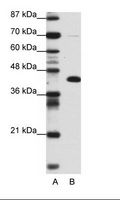 ZBTB25 Antibody - A: Marker, B: Transfected 293T Cell Lysate.  This image was taken for the unconjugated form of this product. Other forms have not been tested.
