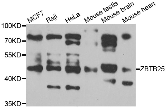 ZBTB25 Antibody - Western blot analysis of extracts of various cell lines.