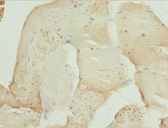 ZBTB25 Antibody - Immunohistochemistry of paraffin-embedded human skeletal muscle tissue at dilution 1:100