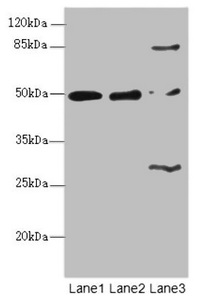 ZBTB25 Antibody - Western blot All Lanes:ZBTB25 antibody at 1.41ug/ml Lane 1 : MCF7 whole cell lysate Lane 2 : Hela whole cell lysate Lane 3 : Mouse kidney tissue Secondary Goat polyclonal to Rabbit IgG at 1/10000 dilution Predicted band size: 49 kDa Observed band size: 49,84,28 kDa
