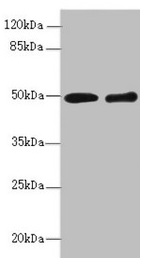 ZBTB25 Antibody - Western blot All lanes: ZBTB25 antibody at 1.41µg/ml Lane 1: MCF-7 whole cell lysate Lane 2: Hela whole cell lysate Secondary Goat polyclonal to rabbit IgG at 1/10000 dilution Predicted band size: 49 kDa Observed band size: 49 kDa
