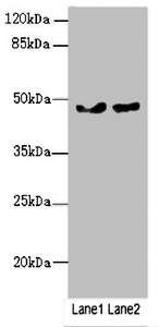 ZBTB25 Antibody - Western blot All Lanes:ZBTB25 antibody at 0.43ug/ml Lane 1 : MCF7 whole cell lysate Lane 2 : Hela whole cell lysate Secondary Goat polyclonal to Rabbit IgG at 1/10000 dilution Predicted band size: 49 kDa Observed band size: 49 kDa