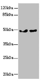 ZBTB25 Antibody - Western blot All lanes: ZBTB25 antibody at 0.43µg/ml Lane 1: MCF-7 whole cell lysate Lane 2: Hela whole cell lysate Secondary Goat polyclonal to rabbit IgG at 1/10000 dilution Predicted band size: 49 kDa Observed band size: 49 kDa