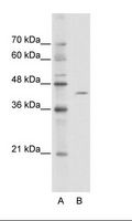 ZBTB26 Antibody - A: Marker, B: Jurkat Cell Lysate.  This image was taken for the unconjugated form of this product. Other forms have not been tested.