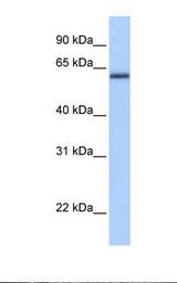 ZBTB26 Antibody - Fetal heart lysate. Antibody concentration: 1.0 ug/ml. Gel concentration: 12%.  This image was taken for the unconjugated form of this product. Other forms have not been tested.