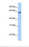 ZBTB26 Antibody - Fetal heart lysate. Antibody concentration: 1.0 ug/ml. Gel concentration: 12%.  This image was taken for the unconjugated form of this product. Other forms have not been tested.