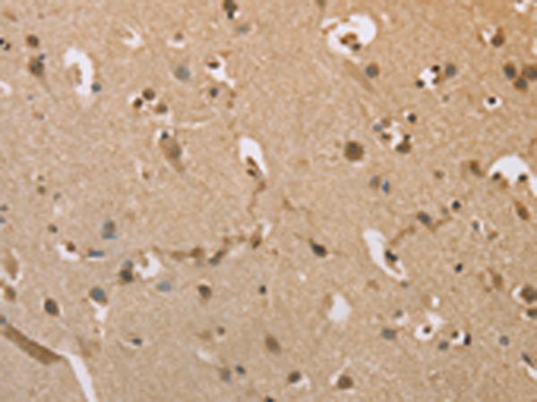 ZBTB26 Antibody - Immunohistochemistry of paraffin-embedded Human brain tissue  using ZBTB26  Polyclonal Antibody at dilution of 1:50(×200)