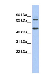 ZBTB26 Antibody - ZBTB26 antibody Western blot of PANC1 cell lysate. This image was taken for the unconjugated form of this product. Other forms have not been tested.