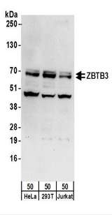 ZBTB3 Antibody - Detection of Human ZBTB3 by Western Blot. Samples: Whole cell lysate (50 ug) from HeLa, 293T, and Jurkat cells. Antibodies: Affinity purified rabbit anti-ZBTB3 antibody used for WB at 0.1 ug/ml. Detection: Chemiluminescence with an exposure time of 30 seconds.