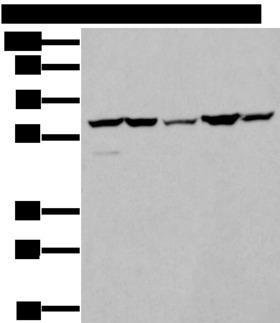 ZBTB3 Antibody - Western blot analysis of A549 A172 HT-29 HEPG2 and Hela cell lysates  using ZBTB3 Polyclonal Antibody at dilution of 1:550