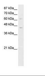 ZBTB3 Antibody - Jurkat Cell Lysate.  This image was taken for the unconjugated form of this product. Other forms have not been tested.