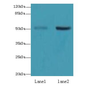 ZBTB32 / TZFP Antibody - Western blot. All lanes: ZBTB32 antibody at 4 ug/ml. Lane 1: Mouse brain tissue. Lane 2: Jurkat whole cell lysate. Secondary Goat polyclonal to Rabbit IgG at 1:10000 dilution. Predicted band size: 53 kDa. Observed band size: 53 kDa.