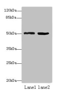 ZBTB32 / TZFP Antibody - Western blot All lanes: ZBTB32 antibody at 4µg/ml Lane 1: Mouse brain tissue Lane 2: Jurkat whole cell lysate Secondary Goat polyclonal to rabbit IgG at 1/10000 dilution Predicted band size: 53 kDa Observed band size: 53 kDa