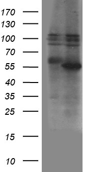 ZBTB32 / TZFP Antibody - HEK293T cells were transfected with the pCMV6-ENTRY control. (Left lane) or pCMV6-ENTRY ZBTB32. (Right lane) cDNA for 48 hrs and lysed