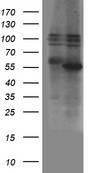 ZBTB32 / TZFP Antibody - HEK293T cells were transfected with the pCMV6-ENTRY control. (Left lane) or pCMV6-ENTRY ZBTB32. (Right lane) cDNA for 48 hrs and lysed