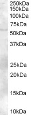 ZBTB32 / TZFP Antibody - Antibody (2 ug/ml) staining of Human Bone Marrow lysate (35 ug protein in RIPA buffer). Primary incubation was 1 hour. Detected by chemiluminescence.