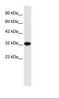 ZBTB32 / TZFP Antibody - HepG2 Cell Lysate.  This image was taken for the unconjugated form of this product. Other forms have not been tested.