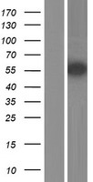ZBTB32 / TZFP Protein - Western validation with an anti-DDK antibody * L: Control HEK293 lysate R: Over-expression lysate