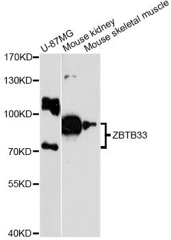 ZBTB33 / Kaiso Antibody - Western blot analysis of extracts of various cell lines, using ZBTB33 antibody at 1:3000 dilution. The secondary antibody used was an HRP Goat Anti-Rabbit IgG (H+L) at 1:10000 dilution. Lysates were loaded 25ug per lane and 3% nonfat dry milk in TBST was used for blocking. An ECL Kit was used for detection and the exposure time was 90s.