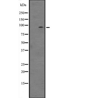 ZBTB33 / Kaiso Antibody - Western blot analysis of ZBTB33 expression in NIH3T3 whole cells lysate. The lane on the left is treated with the antigen-specific peptide.